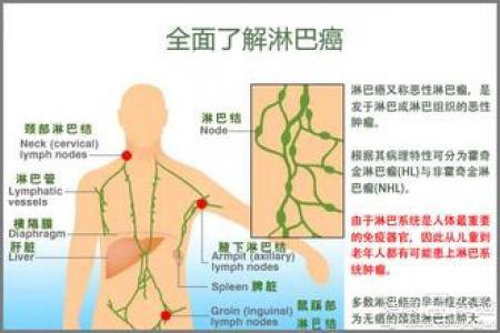 脖子淋巴癌早期癥狀圖片視頻