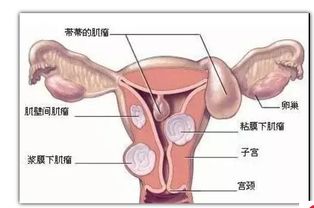 子宮內(nèi)膜增厚是什么意思